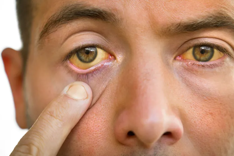 yellow-eyes
